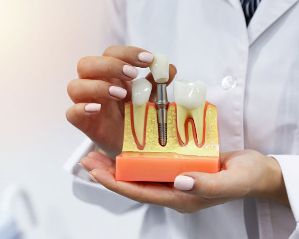 Restorative Dentistry