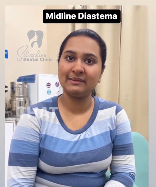Midline Diastema - Reason & Solutions - Dr. Adrija Sarkar