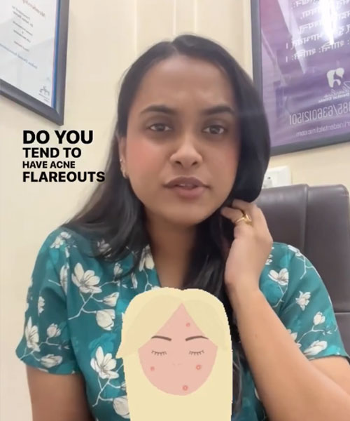 Period & Acne - Dr. Surabhi Sarkar