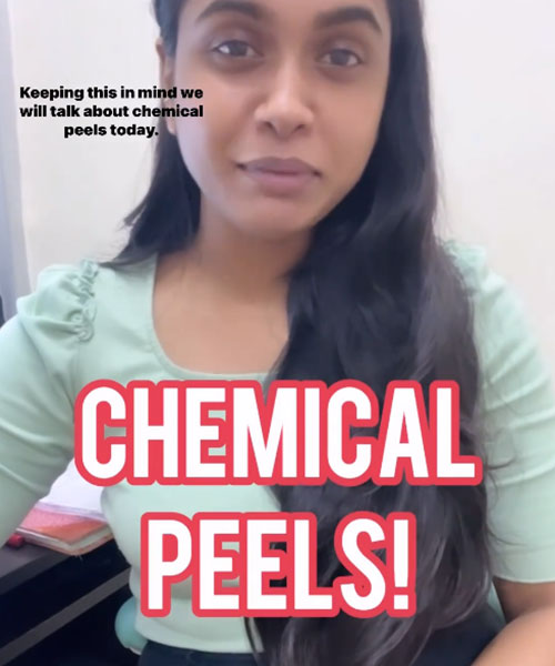 Chemical Peels - what it is and how it works?